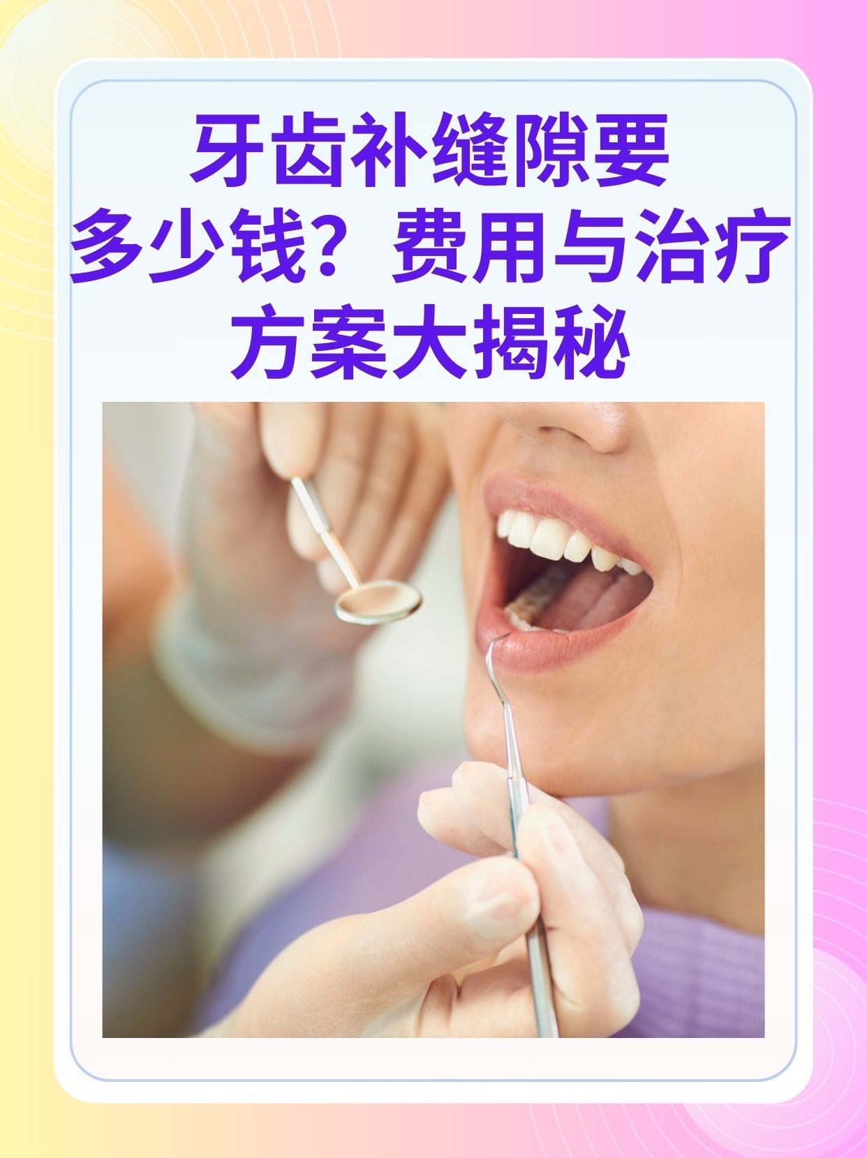 拉萨补牙医保可以报销吗(补牙医保可以报销吗 哪些可以报销呢)